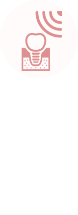 超音波を使ったインプラント